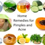 6 Best Home Remedies for Pimples and Acne