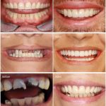 Cosmetic Dentistry